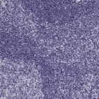 Immunohistochemical staining of human tonsil shows no positivity in non-germinal center cells as expected.