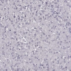 Immunohistochemical staining of human liver shows no positivity in hepatocytes as expected.