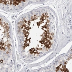 Immunohistochemical staining of human testis shows high expression.