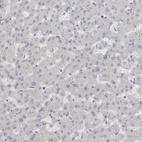 Immunohistochemical staining of human liver shows low expression as expected.