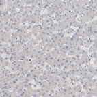 Immunohistochemical staining of human liver shows low expression as expected.