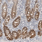 Anti-HCN3 Antibody