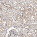Immunohistochemical staining of human kidney shows weak cytoplasmic positivity in cells in tubules.