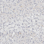 Immunohistochemical staining of human liver shows no positivity in hepatocytes as expected.