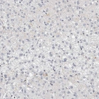 Immunohistochemical staining of human liver shows no positivity in hepatocytes as expected.
