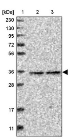 Lane 1: Marker [kDa] 230, 130, 95, 72, 56, 36, 28, 17, 11_br/_Lane 2: Human cell line RT-4_br/_Lane 3: Human cell line U-251MG sp