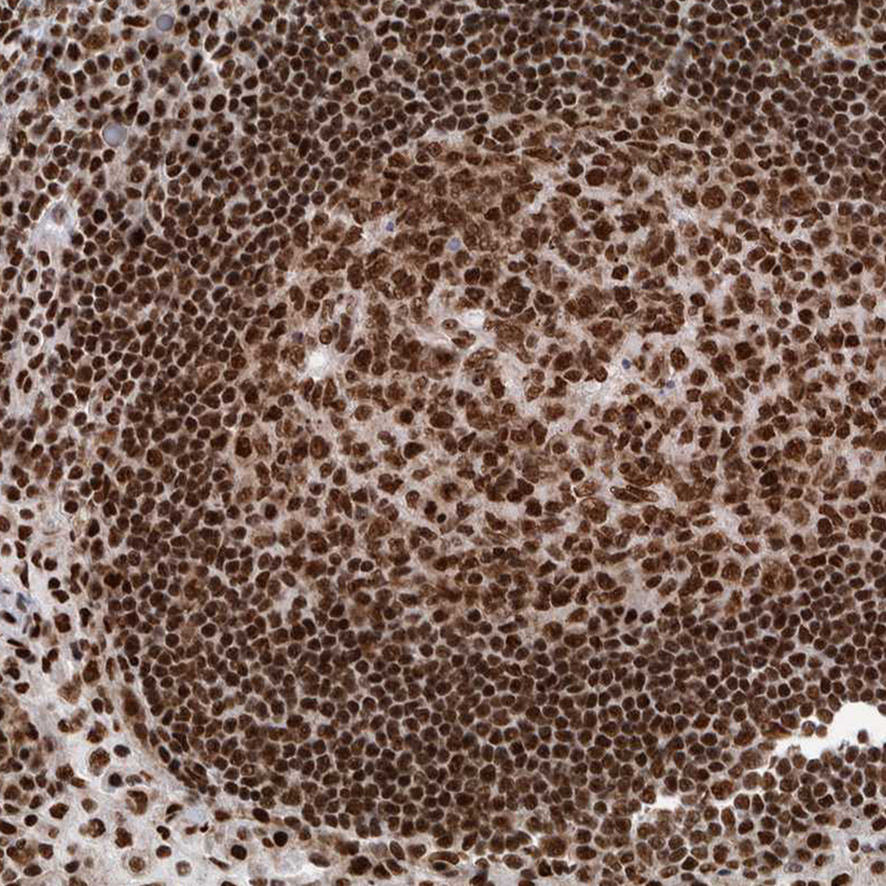 Anti-DNMT3A Antibody