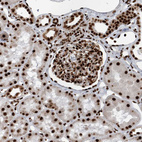 Immunohistochemical staining of human kidney shows nuclear positivity in cells in glomeruli and tubular cells.