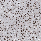 Immunohistochemical staining of human liver shows strong nuclear positivity in hepatocytes.