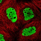 Immunofluorescent staining of human cell line A-431 shows localization to nucleoplasm.