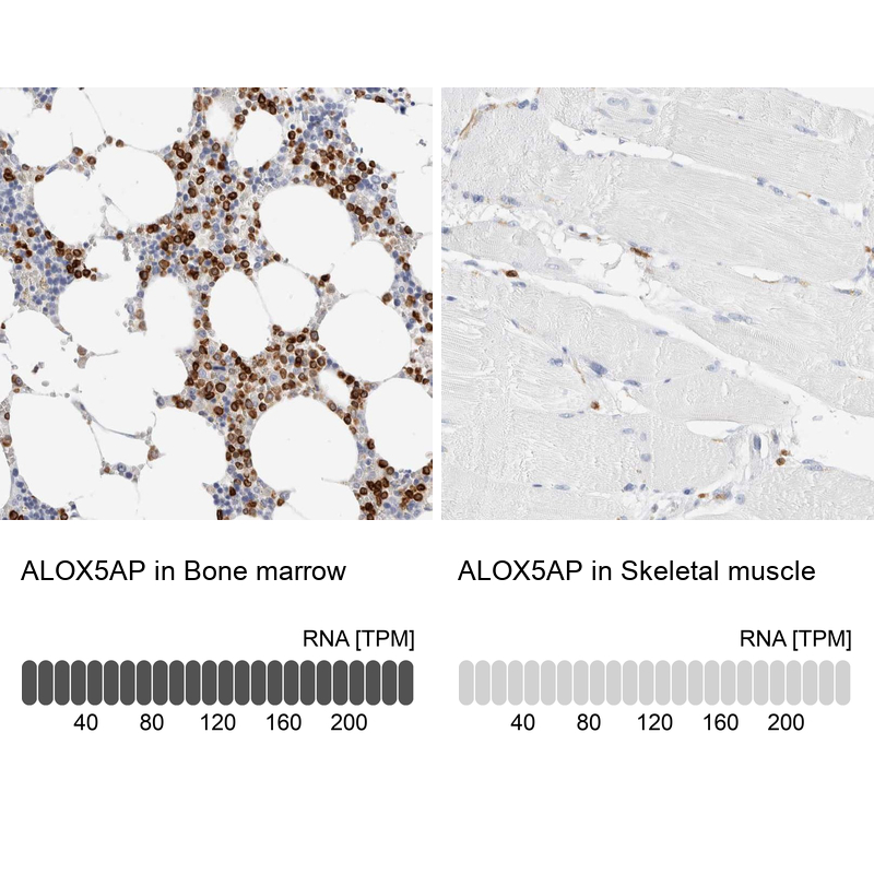 Anti-ALOX5AP Antibody