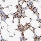 Immunohistochemical staining of human bone marrow shows high expression.