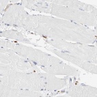 Immunohistochemical staining of human skeletal muscle shows low expression as expected.