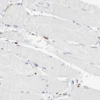 Immunohistochemical staining of human skeletal muscle shows low expression as expected.