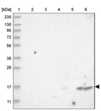 Lane 1: Marker [kDa] 230, 130, 95, 72, 56, 36, 28, 17, 11_br/_Lane 2: Human cell line RT-4_br/_Lane 3: Human cell line U-251MG sp_br/_Lane 4: Human plasma (IgG/HSA depleted)_br/_Lane 5: Human liver tissue_br/_Lane 6: Human tonsil tissue
