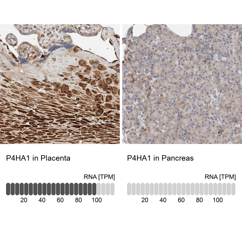 Anti-P4HA1 Antibody
