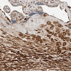 Immunohistochemical staining of human placenta shows strong cytoplasmic positivity in decidual cells.