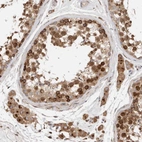 Immunohistochemical staining of human testis shows moderate to strong granular cytoplasmic positivity in cells in seminiferous ducts.