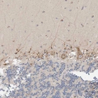 Immunohistochemical staining of human cerebellum shows moderate granular cytoplasmic positivity in Purkinje cells.