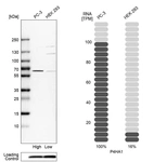 Western blot analysis in human cell lines PC-3 and HEK293 using Anti-P4HA1 antibody. Corresponding P4HA1 RNA-seq data are presented for the same cell lines. Loading control: Anti-PFN1.