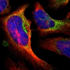 Immunofluorescent staining of human cell line U-2 OS shows localization to endoplasmic reticulum & vesicles.