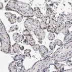 Immunohistochemical staining of human placenta shows moderate nuclear positivity in trophoblastic cells.