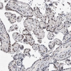 Immunohistochemical staining of human placenta shows moderate nuclear positivity in trophoblastic cells.