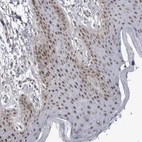 Immunohistochemical staining of human skin shows strong nuclear positivity in squamous epithelial cells.