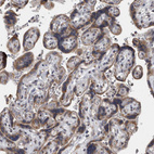 Anti-LMAN2L Antibody