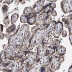 Immunohistochemical staining of human placenta shows moderate granular cytoplasmic positivity in trophoblastic cells.