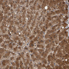 Anti-LMAN2L Antibody