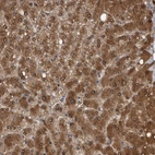 Immunohistochemical staining of human liver shows strong granular cytoplasmic positivity in hepatocytes.