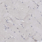 Anti-LMAN2L Antibody