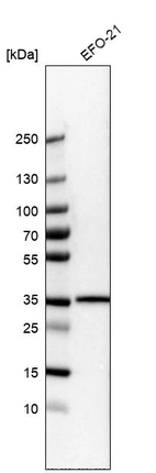 Western blot analysis in human cell line EFO-21.