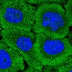 Immunofluorescent staining of human cell line A-431 shows positivity in plasma membrane & cytoplasm.