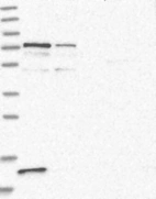 Anti-PPP2R3B Antibody