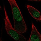 Immunofluorescent staining of human cell line PC-3 shows localization to nucleoplasm.