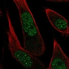 Immunofluorescent staining of human cell line PC-3 shows localization to nucleoplasm.