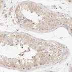 Immunohistochemical staining of human testis shows weak granular cytoplasmic positivity in cells in seminiferous ducts.