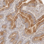 Immunohistochemical staining of human duodenum shows moderate granular cytoplasmic positivity in glandular cells.