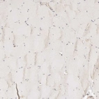 Immunohistochemical staining of human skeletal muscle shows very weak cytoplasmic positivity in myocytes.