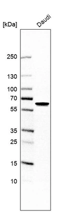 Western blot analysis in human cell line Daudi.