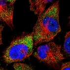 Immunofluorescent staining of human cell line U-251 MG shows localization to cytosol.