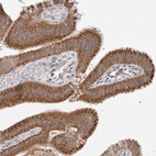 Anti-NPC1 Antibody