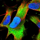 Immunofluorescent staining of human cell line U-251 MG shows localization to nucleoplasm & cytosol.