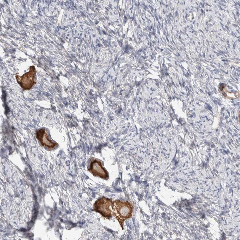 Anti-ANKMY1 Antibody