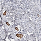 Anti-ANKMY1 Antibody