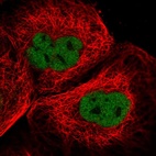 Immunofluorescent staining of human cell line A-431 shows localization to nucleoplasm.