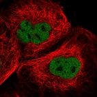 Immunofluorescent staining of human cell line A-431 shows localization to nucleoplasm.