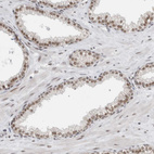 Immunohistochemical staining of human prostate shows moderate nuclear positivity in glandular cells.